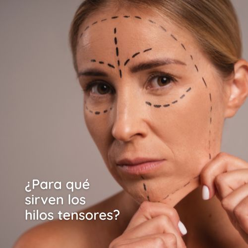 hilos tensores, para qué sirven