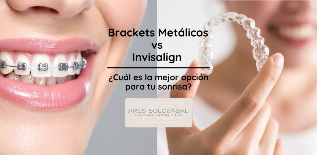 brackets metálicos vs. invisalign. Cuál es la mejor opción para tu sonrisa. Ares Solozábal, clínica dental en Chamberí