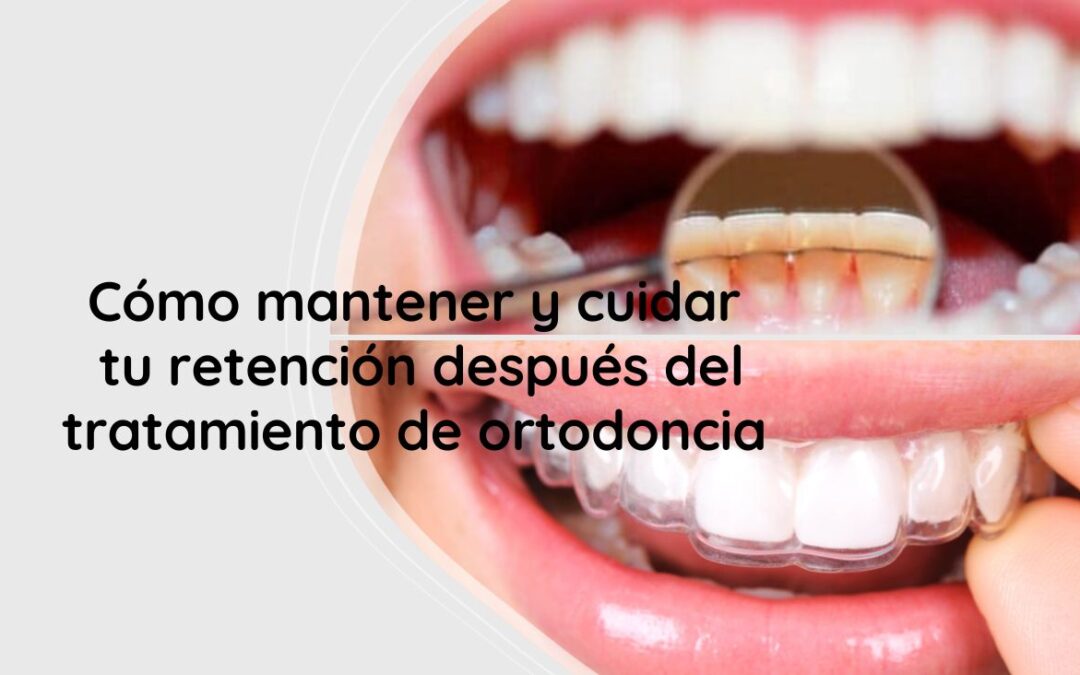 Cómo mantener y cuidar tu retención después del tratamiento de ortodoncia