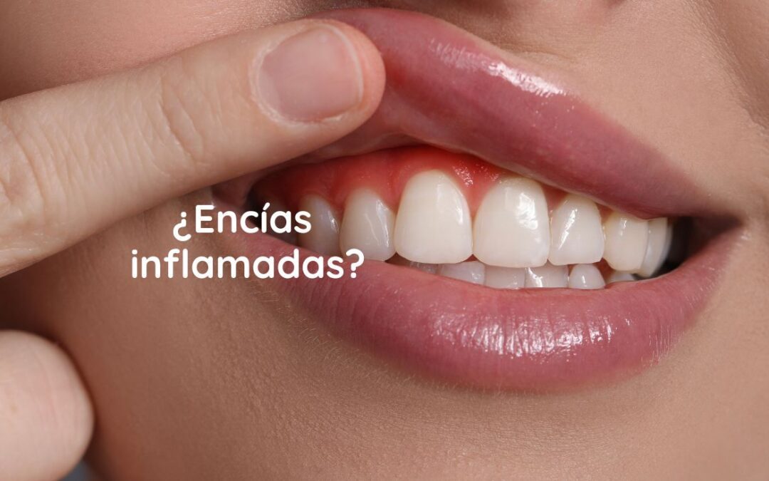 Encías rojas e inflamadas