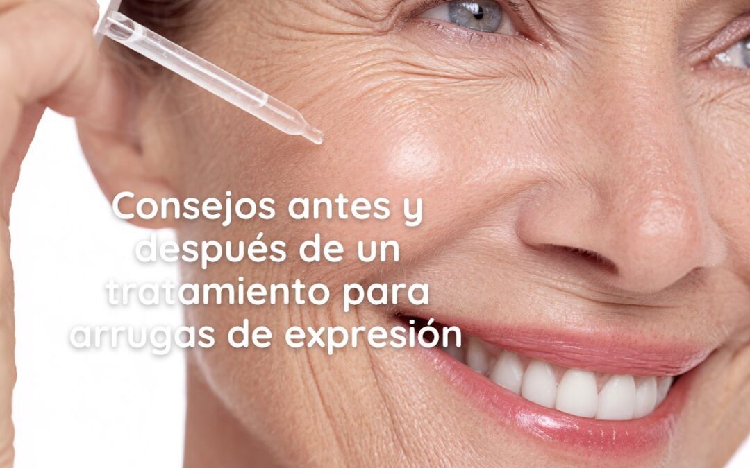 Consejos para Antes y después de un tratamiento para arrugas de expresión