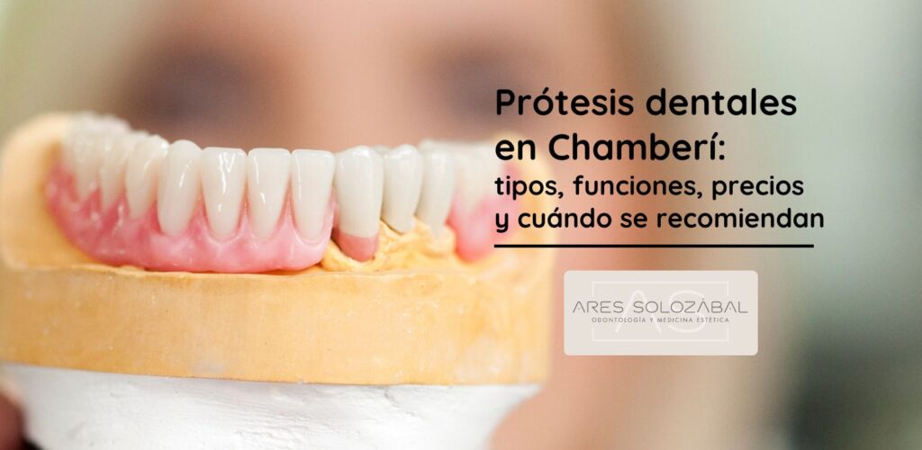 Prótesis dentales en Chamberí tipos, funciones, precios y cuándo se recomiendan