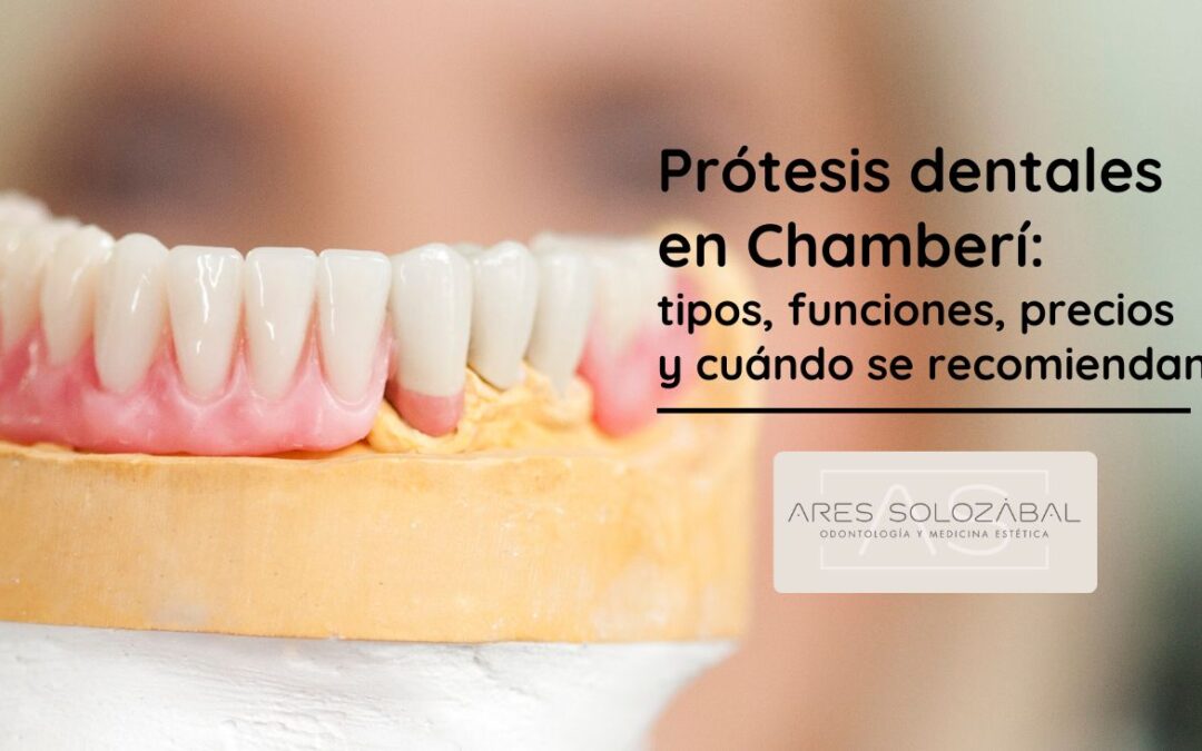 Prótesis dentales en Chamberí: tipos, funciones, precios y cuándo se recomiendan
