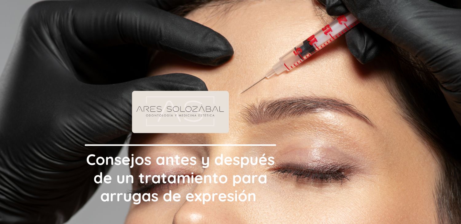 consejos antes y después de un tratamiento para arrugas de expresión 