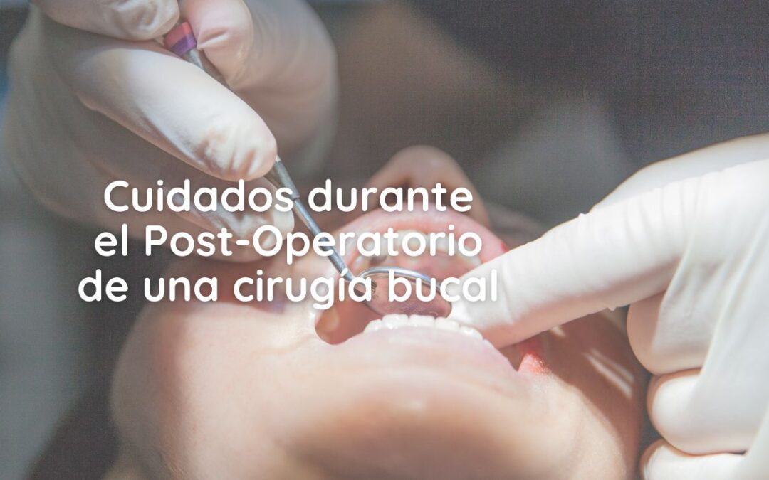 Cuidados durante el Post-Operatorio de una cirugía bucal