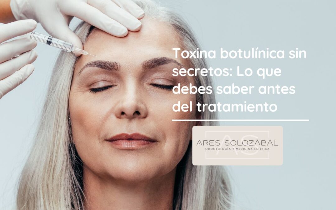 toxina botulínica sin secretos lo que debes saber antes del tratamiento