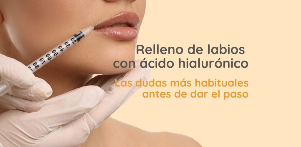 medicina estética en Chamberí, Relleno de labios con ácido hialurónico en Madrid