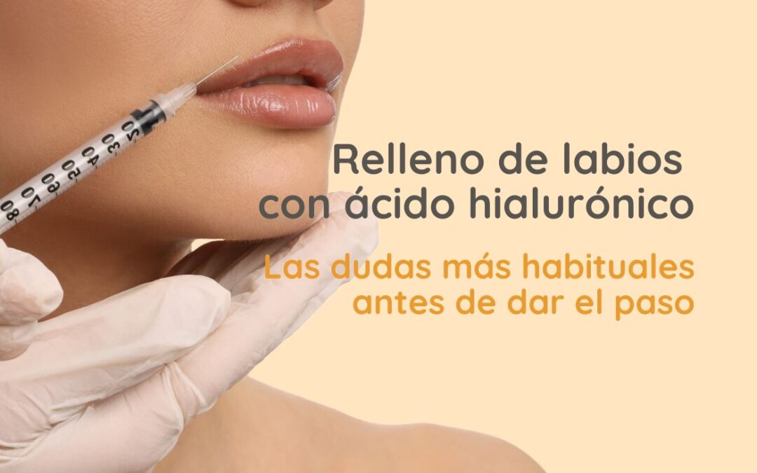 Relleno de labios con ácido hialurónico: las dudas más habituales antes de dar el paso
