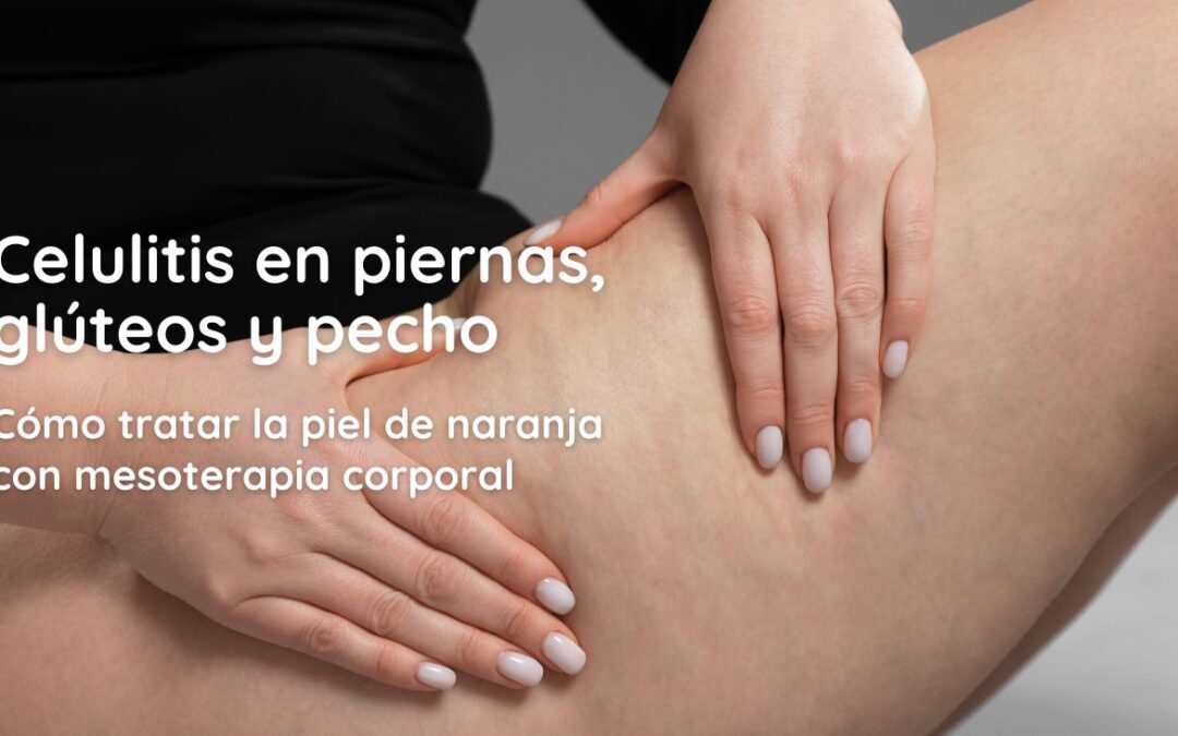 celulitis en piernas, pecho y glúteos, cómo tratarla con mesoterapia corporal