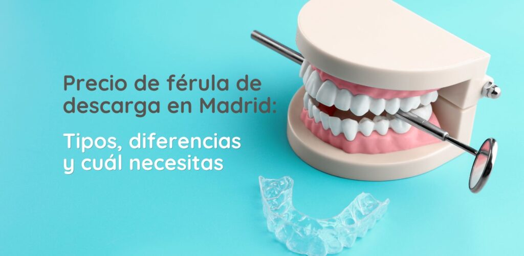 PRECIO férula de descarga en Madrid (